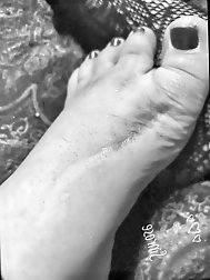 Injured foot needs healing .. still gorgeous
